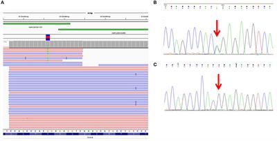 Allelic Dropout Is a Common Phenomenon That Reduces the Diagnostic Yield of PCR-Based Sequencing of Targeted Gene Panels